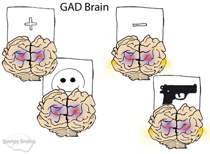 GAD Prediction Brains
