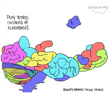 Tetris Brain