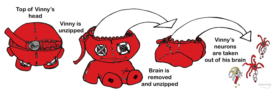 Vinny's Brain