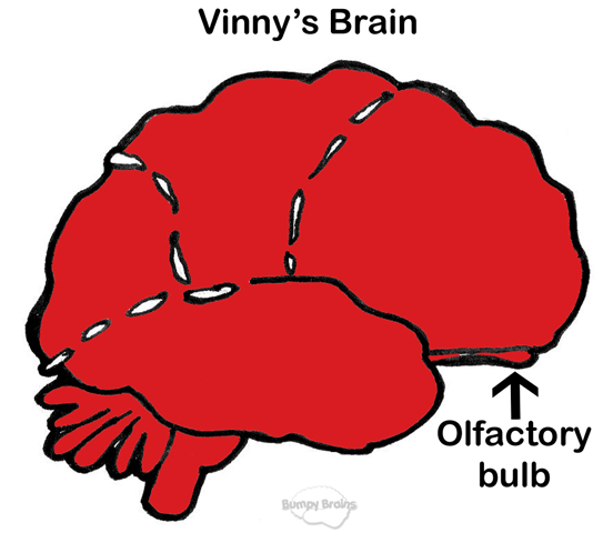 Vinny's Brain