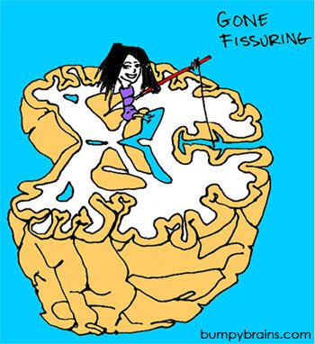 Gone Fissuring