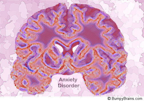 Anxious Brain