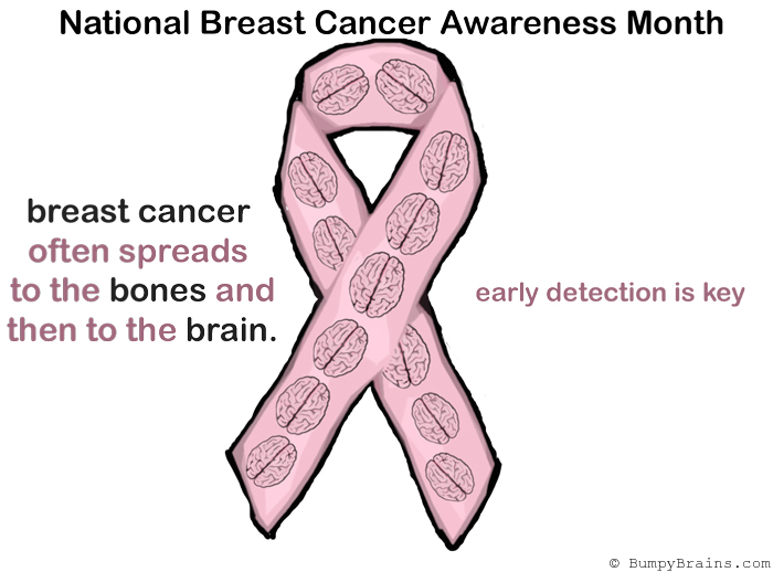 Bumpy Brains Observes Breast Cancer Awareness Month