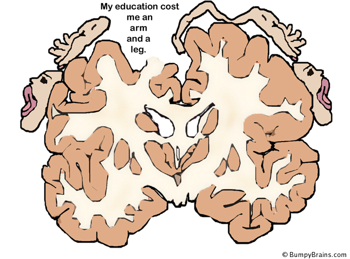 My education cost me an arm and a leg.