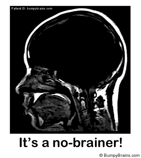 It's a no-brainer!