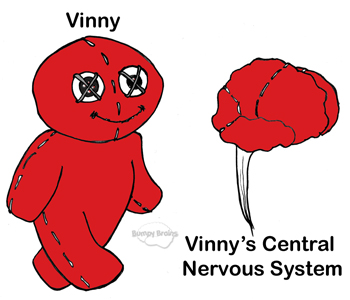 Vinny CNS
